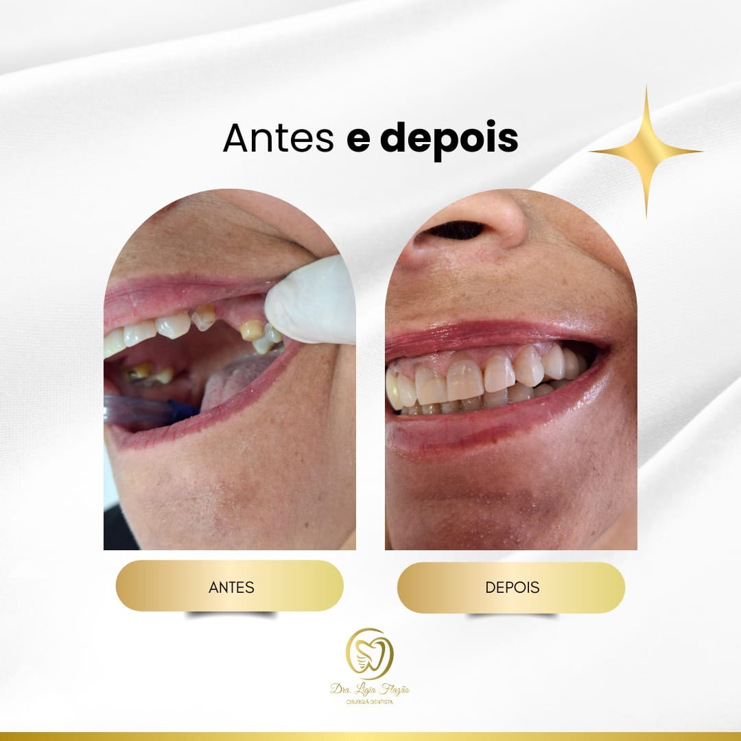 Resultado 3